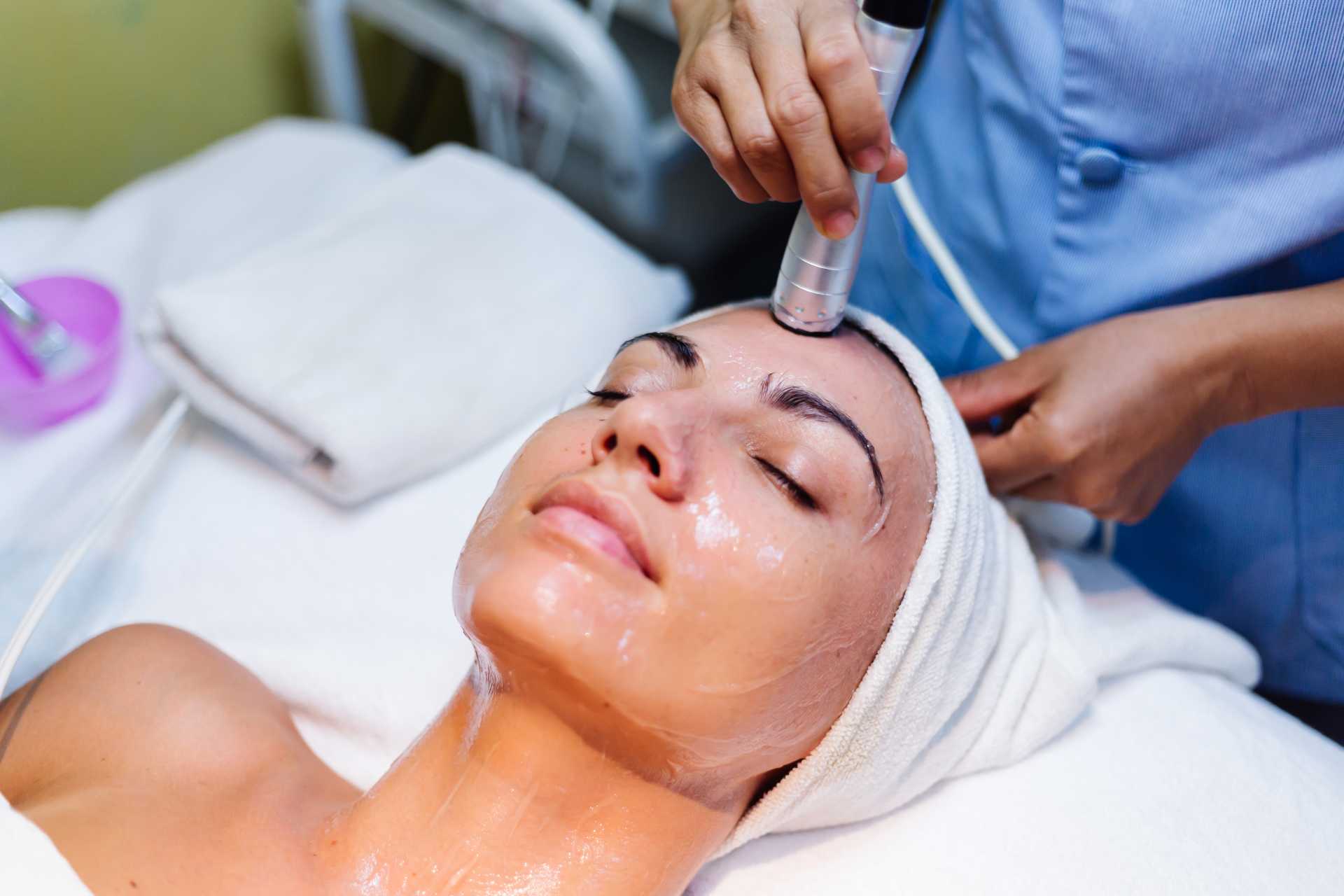 chemical-peel-treatment